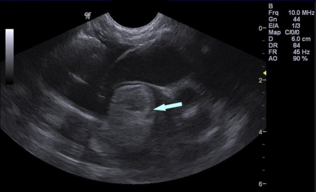 Beautiful view of Symptoms Of Feline Chronic Embolism In Cats